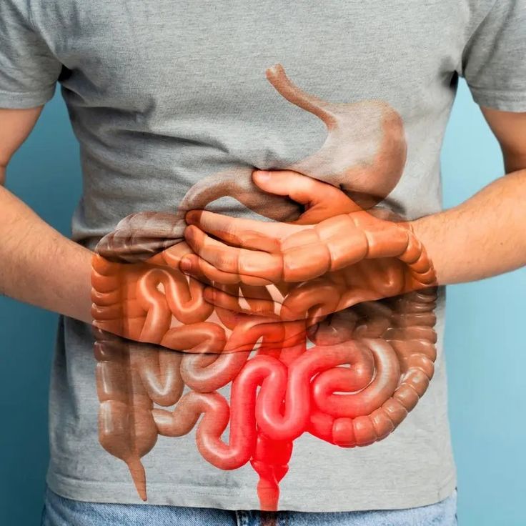 VELARIS™  - GUT SUPPORT CAPSULE